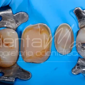 Composito dentale Dentalmax Volvera