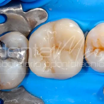 Composito dentale Dentalmax Volvera