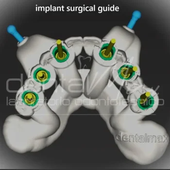 dime chirurgiche dentalmax torino